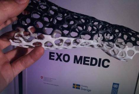 "Exo Medic", izum koji ce zamjeniti gips